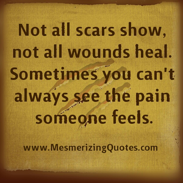 You can't always see the pain someone feels - Mesmerizing Quotes